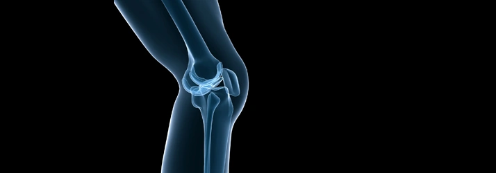 X‑ray style rendering of a knee joint emphasizing bone alignment and surrounding structures.