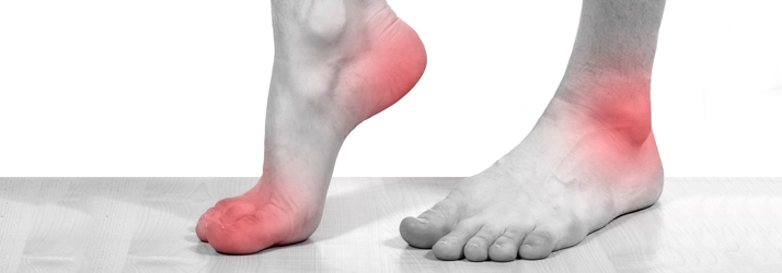 Close‑up of feet highlighting areas of pain and inflammation in the arch and ankle regions.