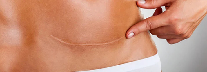 chiropractic care for sciatica and back pain